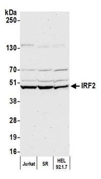 Rabbit anti-IRF2 Antibody, Affinity Purified