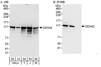 Rabbit anti-DDX42 Antibody, Affinity Purified