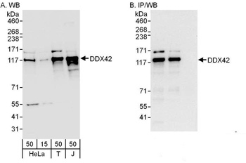 Rabbit anti-DDX42 Antibody, Affinity Purified
