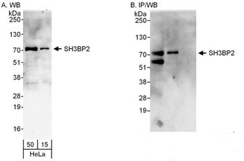 Rabbit anti-SH3BP2 Antibody, Affinity Purified