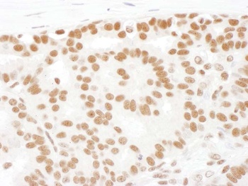 Rabbit anti-SF1 Antibody, Affinity Purified