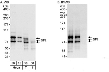 Rabbit anti-SF1 Antibody, Affinity Purified