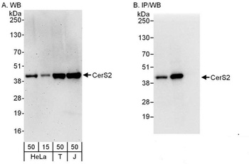 Rabbit anti-CerS2 Antibody, Affinity Purified