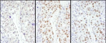 Rabbit anti-HSF1 Antibody, Affinity Purified