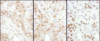 Rabbit anti-HSF1 Antibody, Affinity Purified