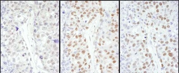 Rabbit anti-HSF1 Antibody, Affinity Purified