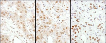 Rabbit anti-HSF1 Antibody, Affinity Purified