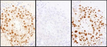 Rabbit anti-HDGF Antibody, Affinity Purified