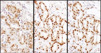 Rabbit anti-HDGF Antibody, Affinity Purified