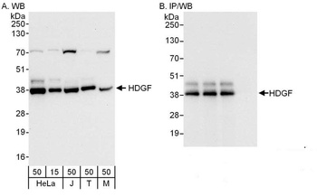 Rabbit anti-HDGF Antibody, Affinity Purified