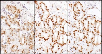 Rabbit anti-HDGF Antibody, Affinity Purified