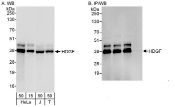 Rabbit anti-HDGF Antibody, Affinity Purified