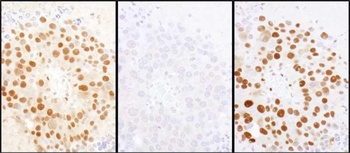 Rabbit anti-HDGF Antibody, Affinity Purified