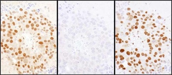 Rabbit anti-HDGF Antibody, Affinity Purified