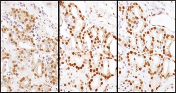 Rabbit anti-HDGF Antibody, Affinity Purified