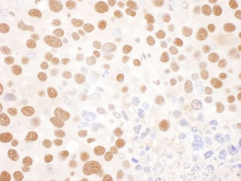 Rabbit anti-NF45 Antibody, Affinity Purified