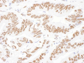 Rabbit anti-NF45 Antibody, Affinity Purified
