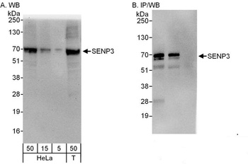 Rabbit anti-SENP3 Antibody, Affinity Purified