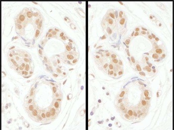 Rabbit anti-SENP3 Antibody, Affinity Purified