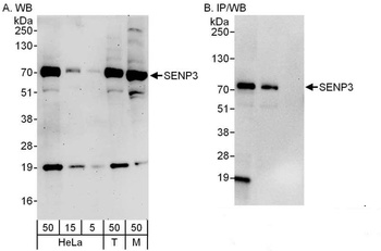 Rabbit anti-SENP3 Antibody, Affinity Purified