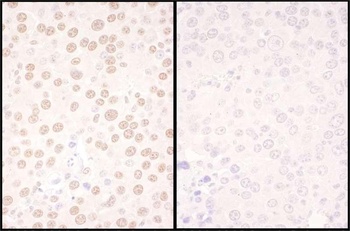 Rabbit anti-NFIC Antibody, Affinity Purified