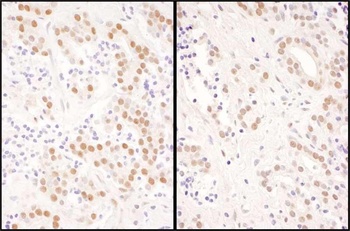 Rabbit anti-NFIC Antibody, Affinity Purified