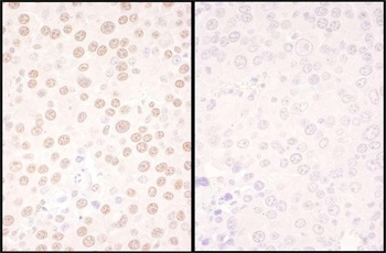 Rabbit anti-NFIC Antibody, Affinity Purified