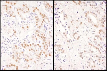 Rabbit anti-NFIC Antibody, Affinity Purified