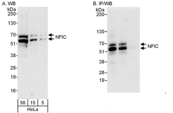 Rabbit anti-NFIC Antibody, Affinity Purified