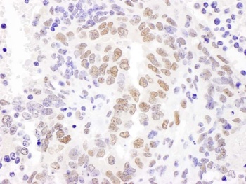 Rabbit anti-HEXIM1 Antibody, Affinity Purified