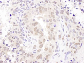 Rabbit anti-HEXIM1 Antibody, Affinity Purified