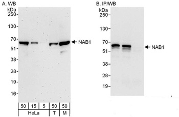 Rabbit anti-NAB1 Antibody, Affinity Purified