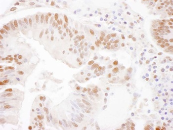 Rabbit anti-SSRP1 Antibody, Affinity Purified