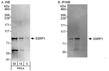 Rabbit anti-SSRP1 Antibody, Affinity Purified