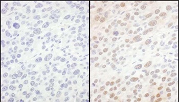 Rabbit anti-eIF6 Antibody, Affinity Purified