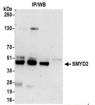 Rabbit anti-SMYD2 Antibody, Affinity Purified