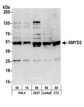 Rabbit anti-SMYD2 Antibody, Affinity Purified