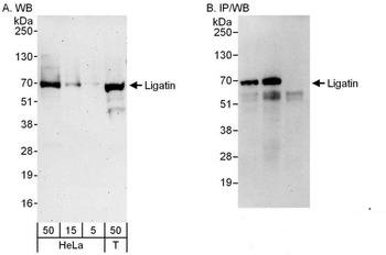 Rabbit anti-Ligatin Antibody, Affinity Purified