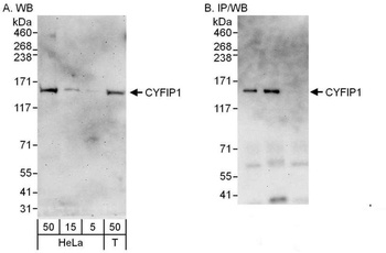 Rabbit anti-CYFIP1 Antibody, Affinity Purified