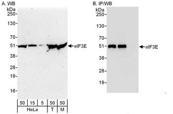 Rabbit anti-eIF3E Antibody, Affinity Purified