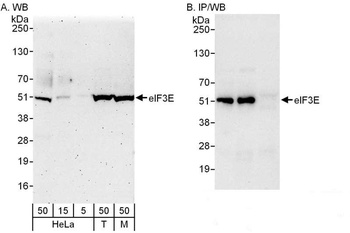 Rabbit anti-eIF3E Antibody, Affinity Purified