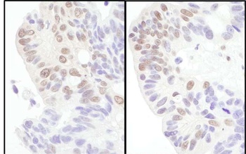 Rabbit anti-eIF4AIII/EIF4A3 Antibody, Affinity Purified
