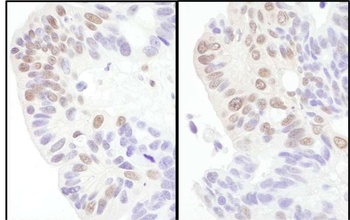 Rabbit anti-eIF4AIII/EIF4A3 Antibody, Affinity Purified