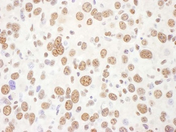 Rabbit anti-eIF4AIII/EIF4A3 Antibody, Affinity Purified