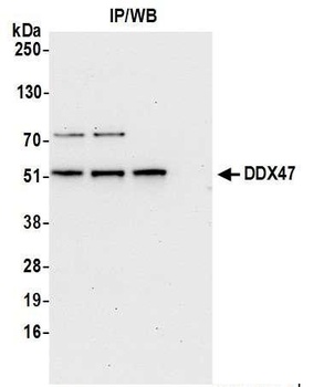 Rabbit anti-DDX47 Antibody, Affinity Purified