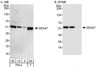 Rabbit anti-DDX47 Antibody, Affinity Purified