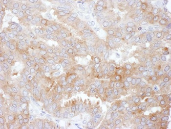 Rabbit anti-NHERF1 Antibody, Affinity Purified