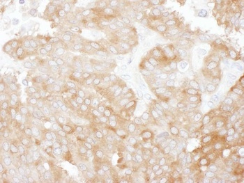 Rabbit anti-NHERF1 Antibody, Affinity Purified