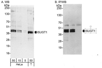 Rabbit anti-SUGT1 Antibody, Affinity Purified