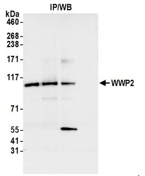 Rabbit anti-WWP2 Antibody, Affinity Purified